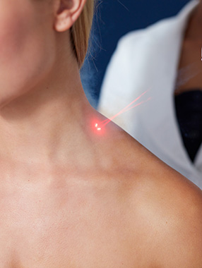 Cold Laser Therapy for Neck Pain Close-up of shoulder with red laser targeting spot, highlighting precise noninvasive skin treatment.