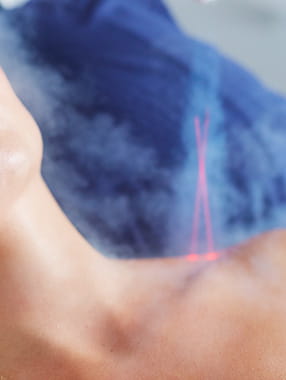 Cold Laser Therapy to reduce shoulder pain Close-up of neck with red laser targeting area, highlighting noninvasive skin tightening treatment.
